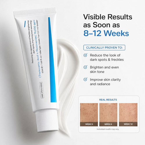 Aftertone Dark Spot Cream with Tranexamic Acid + Niacinamide
